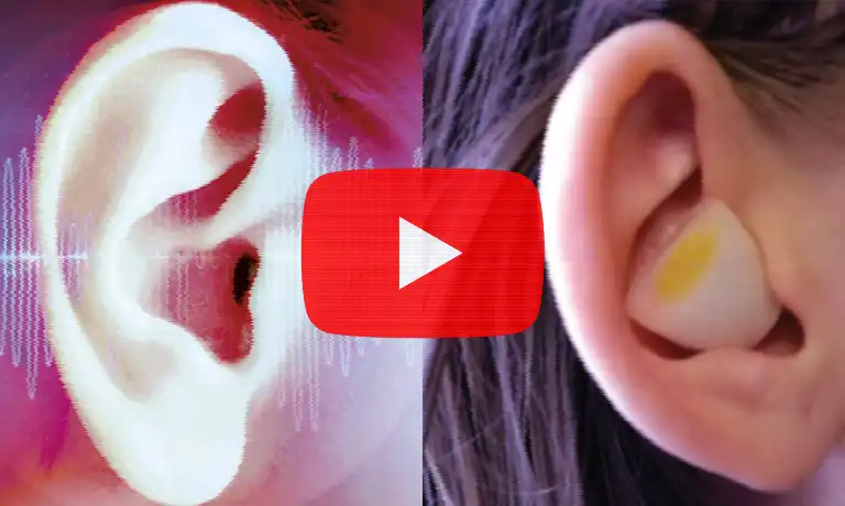 Image show two ears with a garlic in the one and play button.