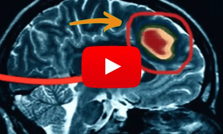 The image show a brain image with a play button for watch video.